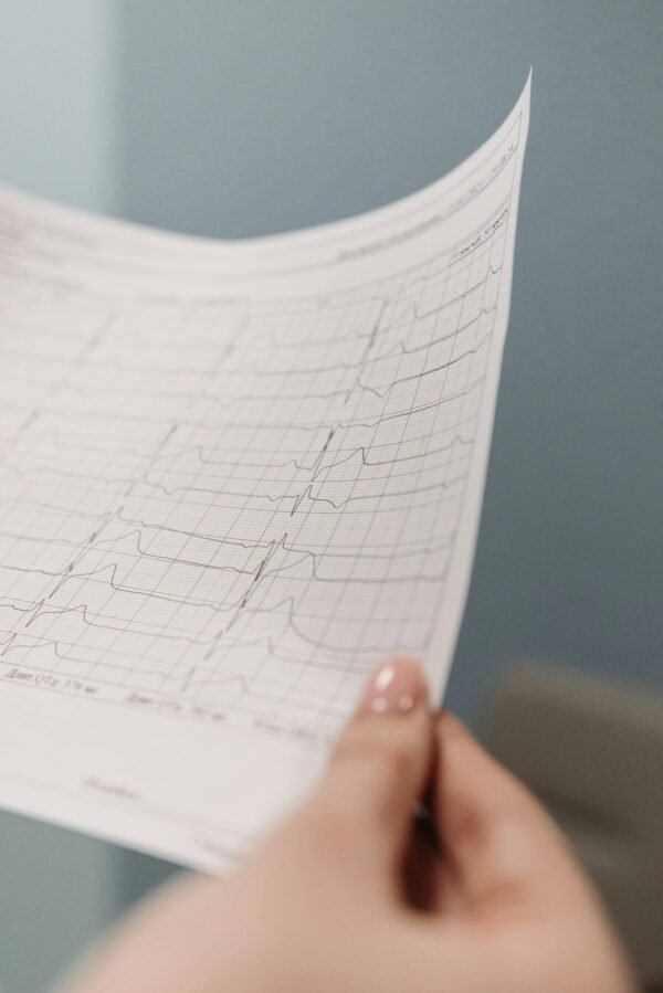 Electrocardiograma