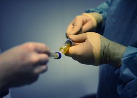 Close-up of healthcare professionals handling a medical sample in a clinical setting.